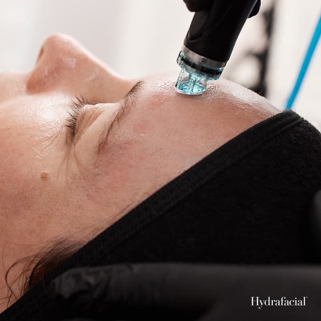 Exclusive Hydrafacial Membership at BELLA HEADSPA in Southlake, TX